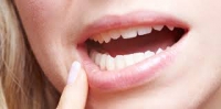 Waspadai Penyakit Dari Gigi dan Mulut